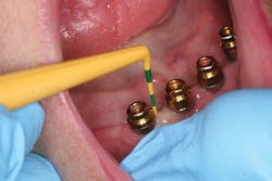 Fig 2 Dr J Remien Fig 2 Dr J Remien