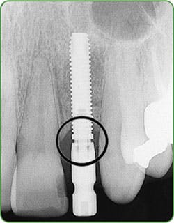 Fig 3a Clearly In Focus Courtesy Of Jeff Carlson Fig 3a Clearly In Focus Courtesy Of Jeff Carlson