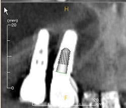 Fig 3b Cbct Rh Fig 3b Cbct Rh