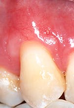 Figure 2 Pm Jd After Figure 2 Pm Jd After