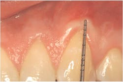Figure 3 Pm Dr Figure 3 Pm Dr