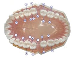 Figure 6 Furcation Chart Figure 6 Furcation Chart
