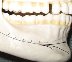 Figure 1 Inc Ment Nvs Figure 1 Inc Ment Nvs