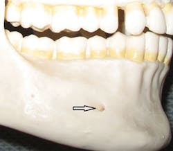 Figure 2 Inc Skull 2 Arrow Figure 2 Inc Skull 2 Arrow
