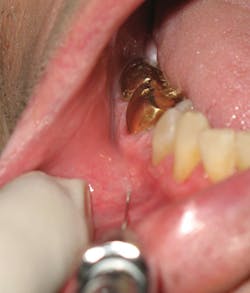 Figure 5 Incisive Figure 5 Incisive