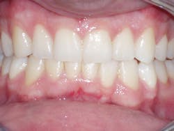 Final Closeup Final Closeup