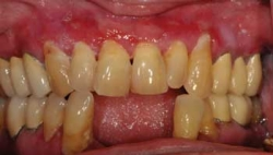 Pennwell web 250 142