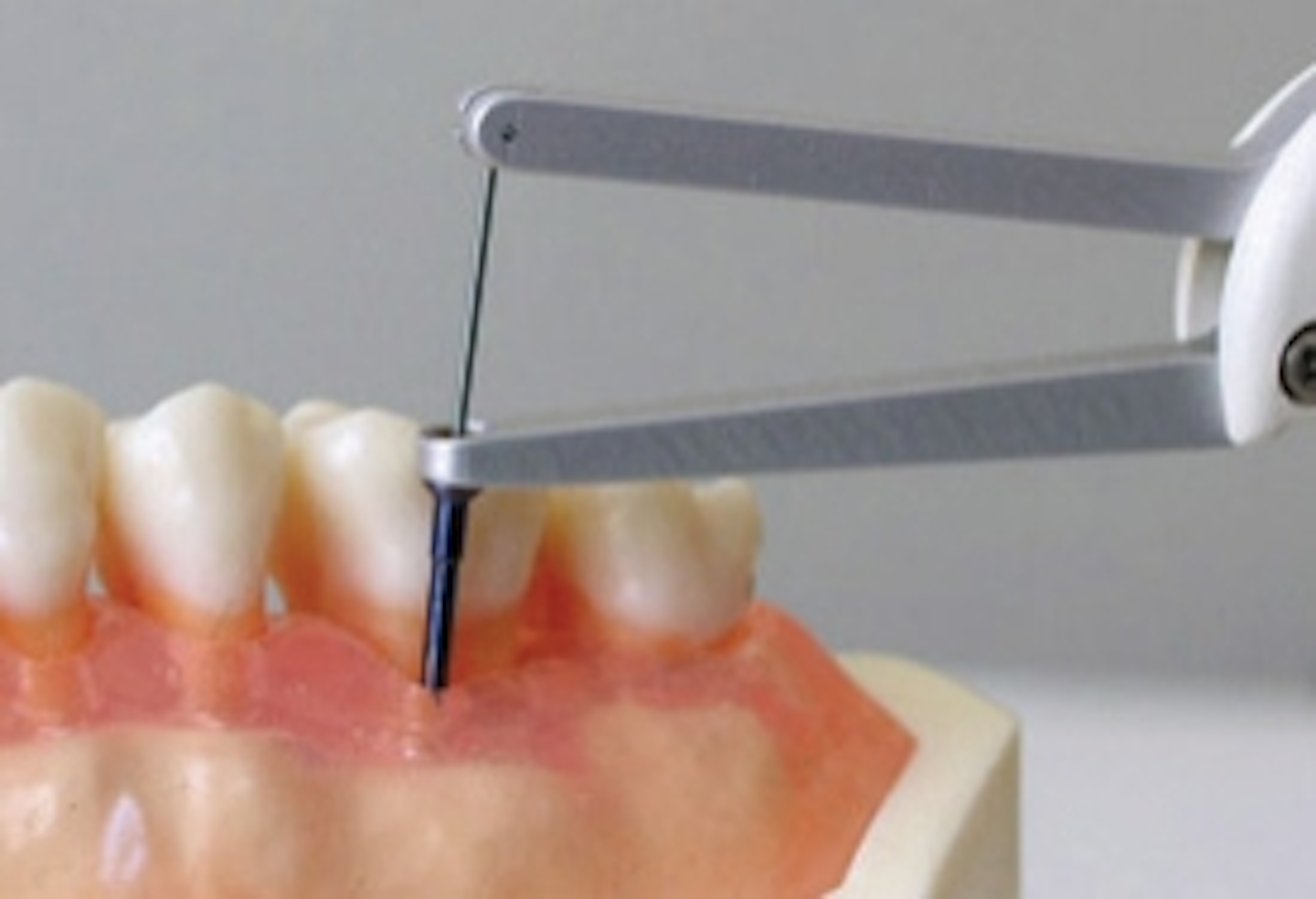 Florida probing in Texas Registered Dental Hygienist (RDH) Magazine