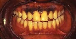 Pennwell web 300 155 Pennwell web 300 155