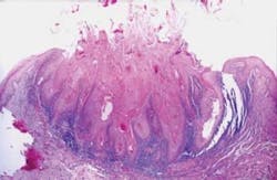 Pennwell web 300 195 Pennwell web 300 195