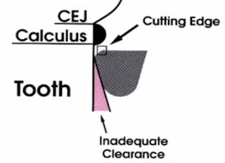 No more dull instruments! | Registered Dental Hygienists