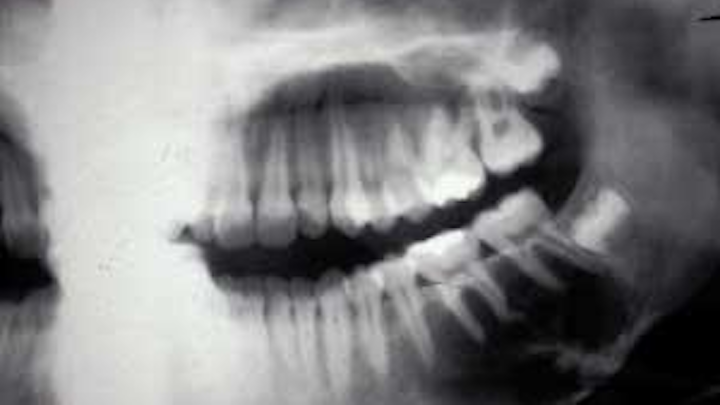 Th 0802rdhtraumatic01