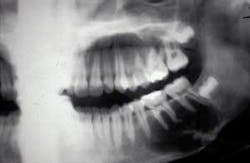 Th 0802rdhtraumatic01 Th 0802rdhtraumatic01