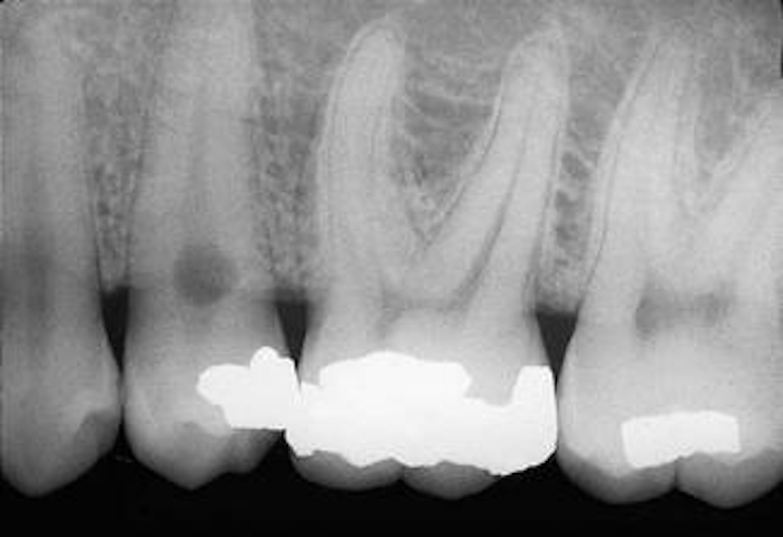 Th 109431