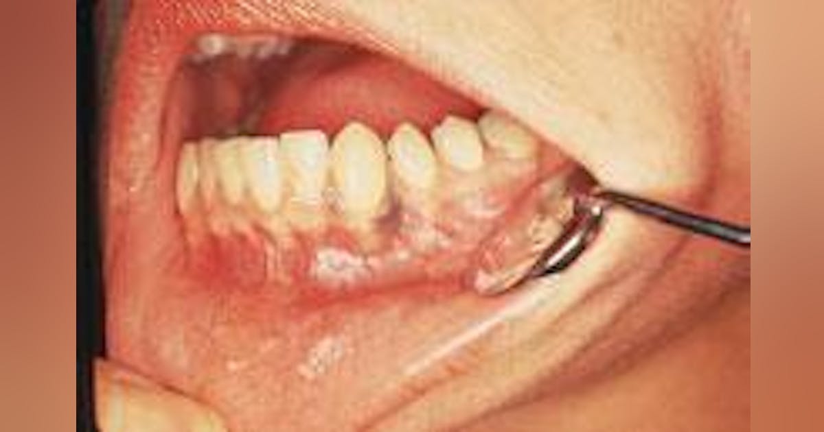 Case #10 | Registered Dental Hygienists