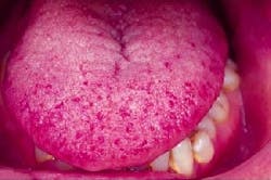 Th 2101rdhcs Th 2101rdhcs