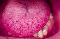 Th 2101rdhcs Th 2101rdhcs