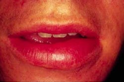 Th 2103rdhcs Th 2103rdhcs