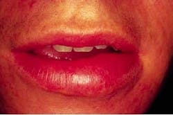 Th 2103rdhcs Th 2103rdhcs