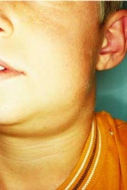 Th 2104rdhcs Th 2104rdhcs