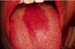 Th 2106rdhcs Th 2106rdhcs