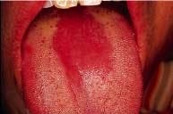 Th 2106rdhcs Th 2106rdhcs