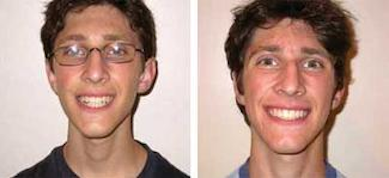 Oral Myofunctional Therapy - General and Cosmetic Dentist