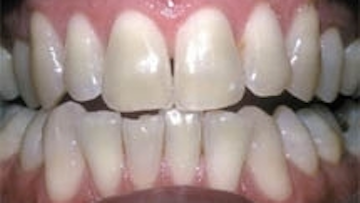 Th 40before