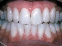 Th 40white Th 40white