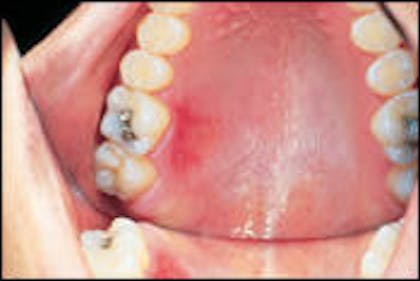 Svare ufuldstændig I virkeligheden Case Study | Registered Dental Hygienists