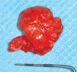 Th Depc Excised3 Th Depc Excised3