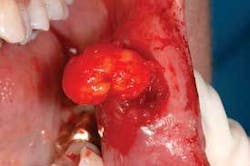 Th Depc Surgery2 Th Depc Surgery2