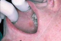 Th Lichen 1009 01 Th Lichen 1009 01