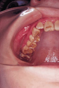 Th Rdh110143 34 Th Rdh110143 34