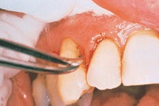 Th Rdh110202 49 Th Rdh110202 49