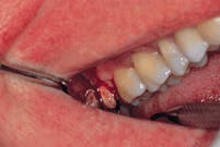 Th Rdh110554 21 Th Rdh110554 21