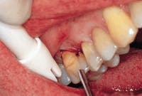 Th Rdh110554 22 Th Rdh110554 22