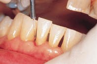 Th Rdh110554 23 Th Rdh110554 23