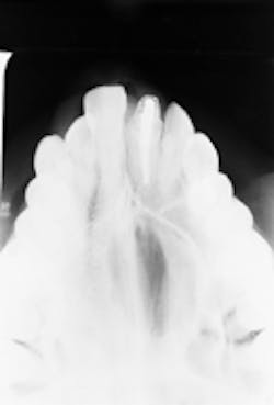 Th Rdh110624 29 Th Rdh110624 29