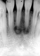 Th Rdh110704 247 Th Rdh110704 247