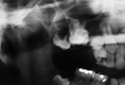 Th Rdh110704 4 Th Rdh110704 4