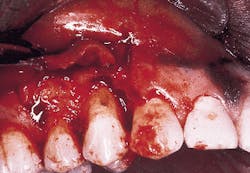 Th Rdh117299 38 Th Rdh117299 38