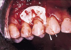 Th Rdh117299 44 Th Rdh117299 44