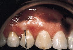 Th Rdh117299 45 Th Rdh117299 45