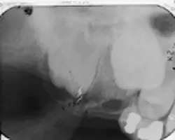 Th Rdh117656 248 Th Rdh117656 248