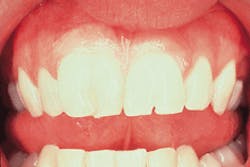 Th Rdh117706 34 Th Rdh117706 34