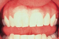 Th Rdh117706 34 Th Rdh117706 34