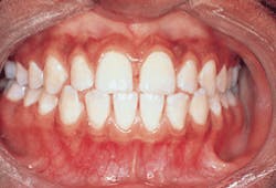 Th Rdh117709 33 Th Rdh117709 33