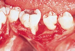 Th Rdh117709 35 Th Rdh117709 35