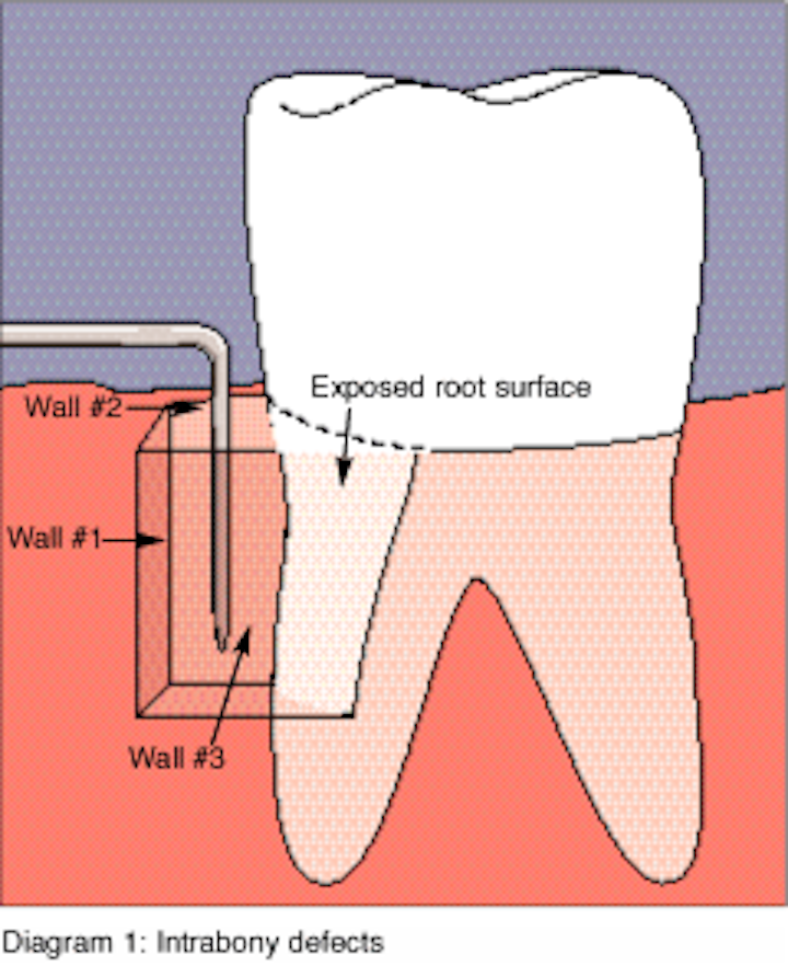 Periodontal Regeneration Registered Dental Hygienist Rdh Magazine